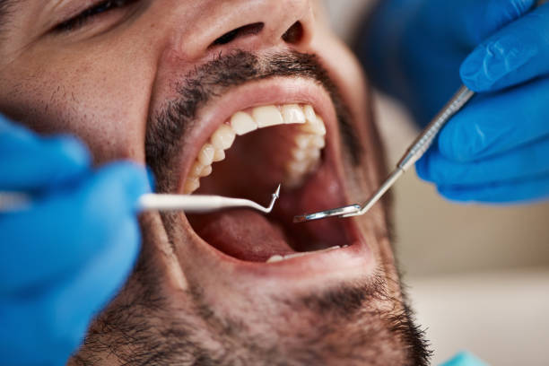 Best Dental Inlays and Onlays  in West Siloam Springs, OK